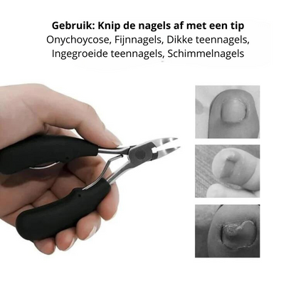 ClipGuard Nagelknipper Set